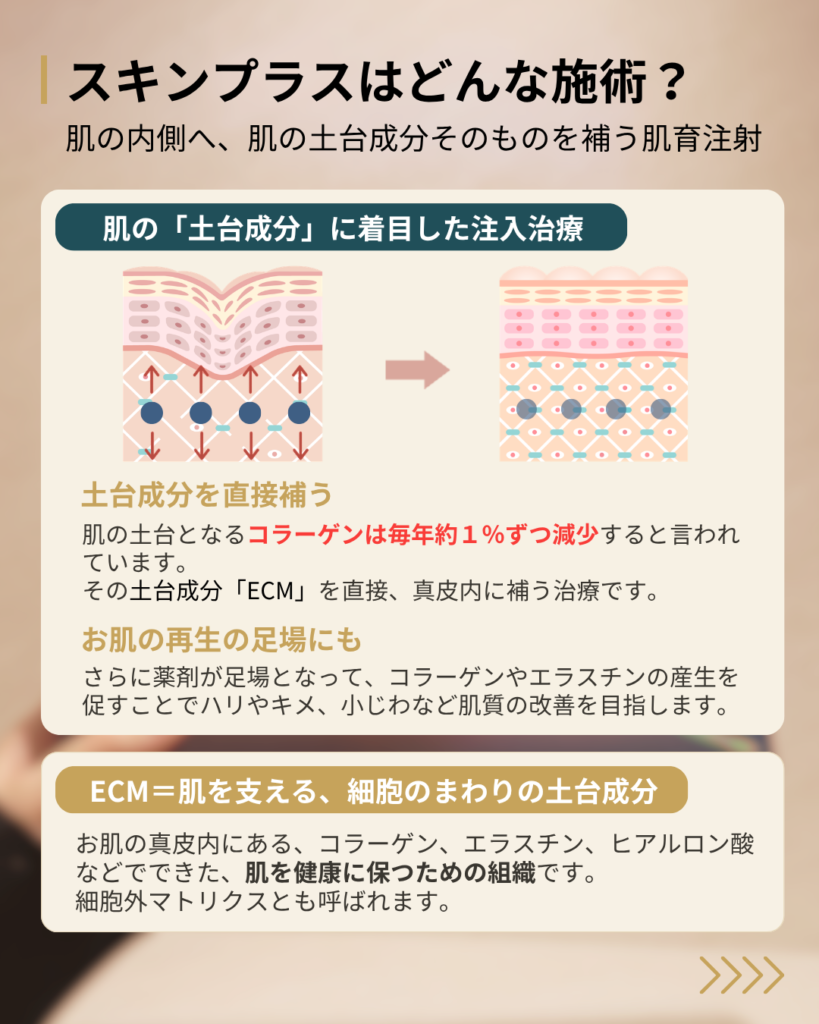 スキンプラスとは