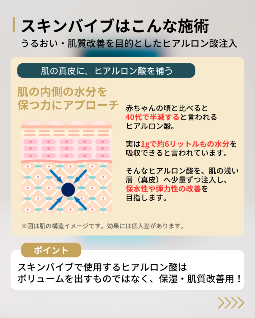 真皮にヒアルロン酸を注入するスキンバイブの仕組み