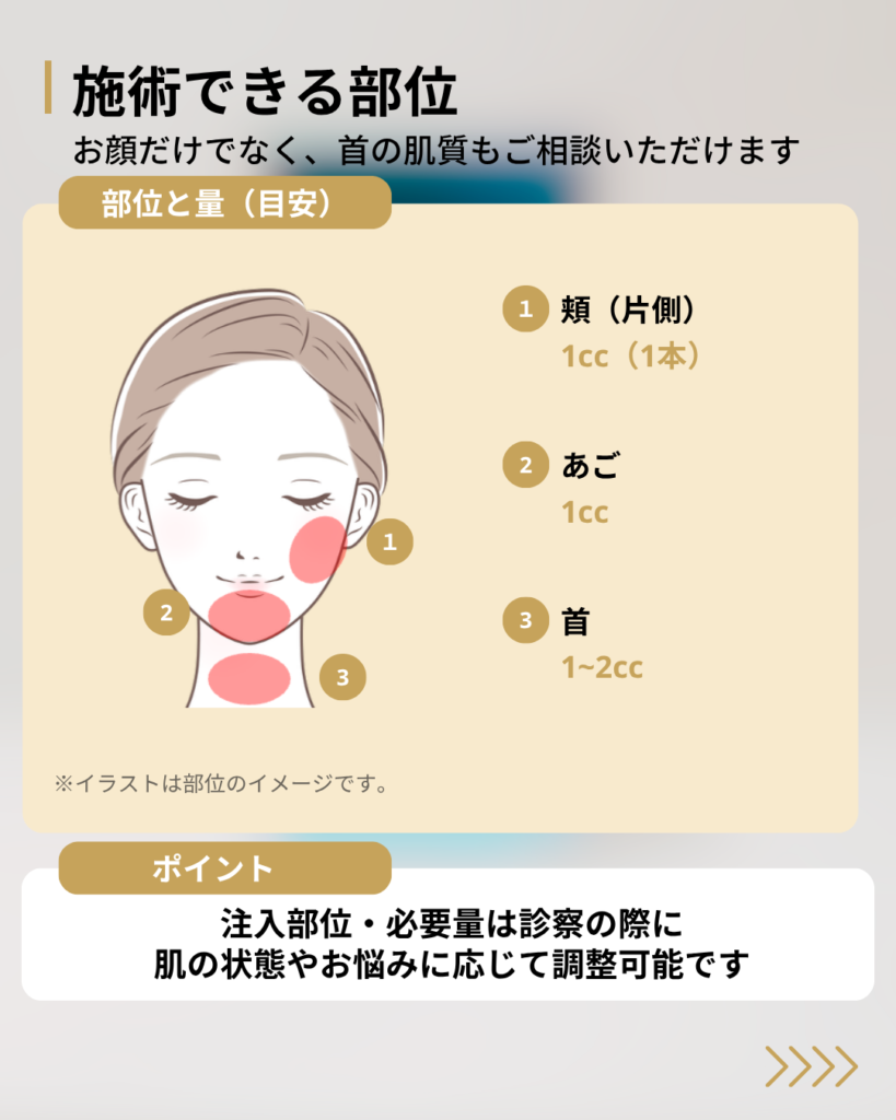 頬・あご・首の注入部位と量の目安