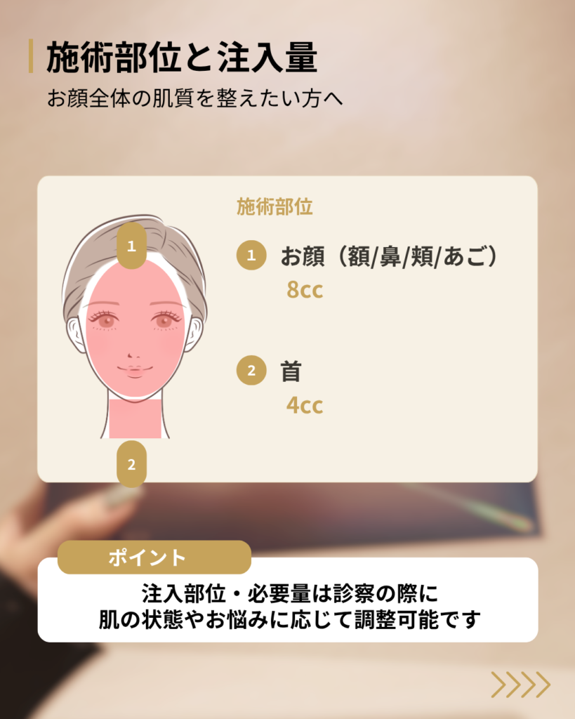 スキンプラスの施術部位と注入量
